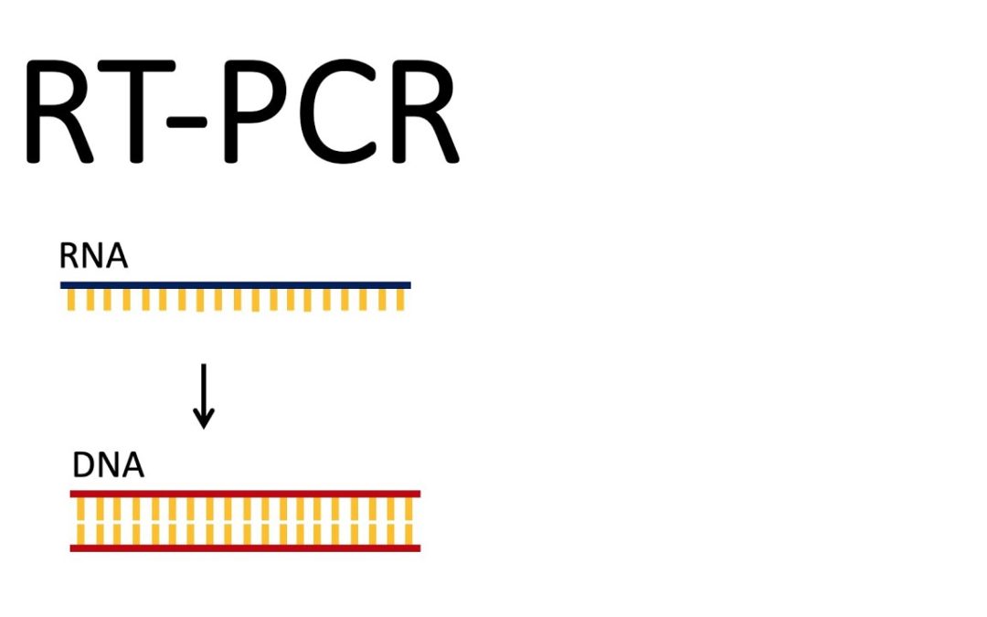 RT-PCR KORONAVİRÜS TESTİ İLE İLGİLİ TÜM HUSUSLAR